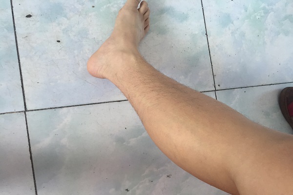 人老腿先知,腿部有3个特征,提示你开始老了,要好好保养身体