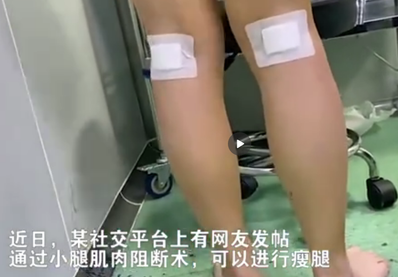 阻断小腿神经来瘦腿?这么说的人昧了良心,做的人是要美不要命!