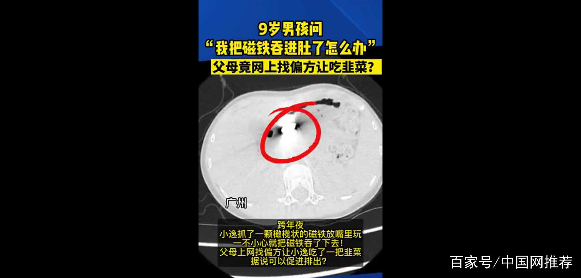 磁铁进肚子_磁铁吃到肚子里能拉出来吗 磁铁进肚子_磁铁吃到肚子里能拉出来吗 磁铁进肚子_磁铁吃到肚子里能拉出来吗(磁铁吃进肚子怎么办) 磁力资讯