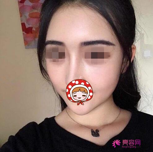 郑大五附院徐扬阳怎么样医院2022整形价格表医生专家案例口碑经验