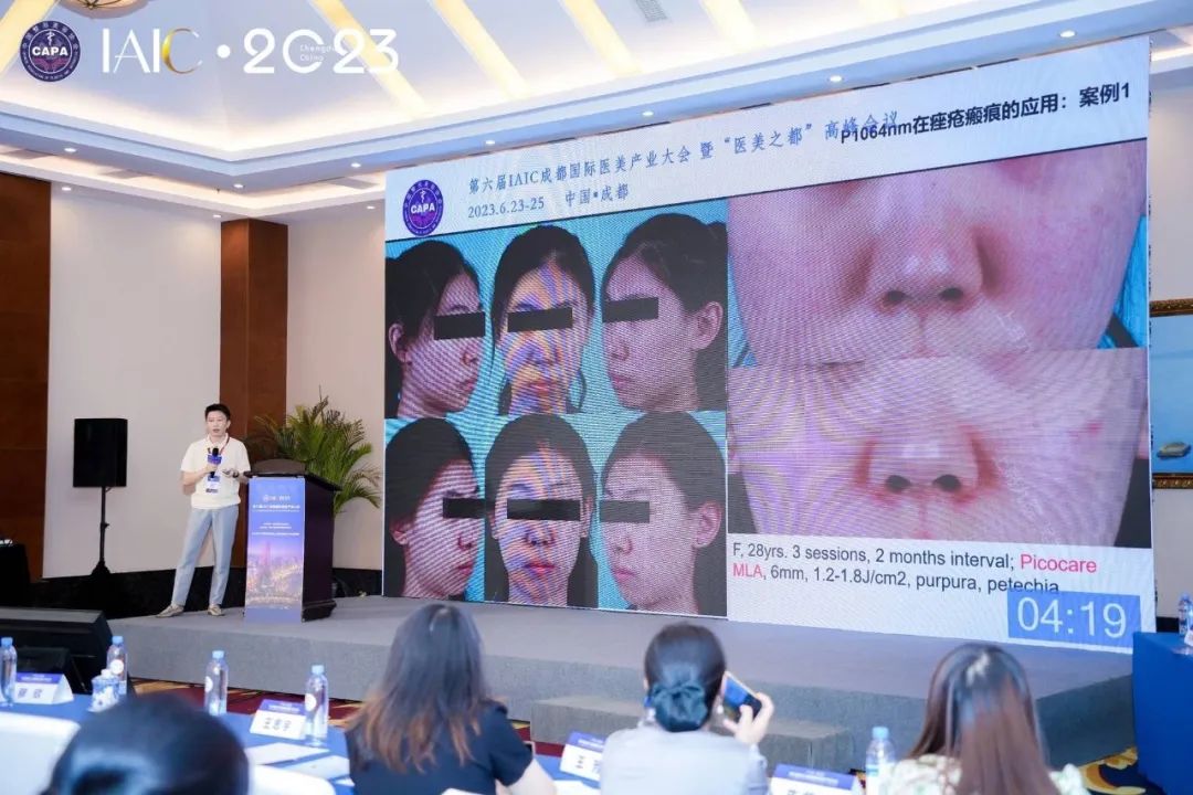 上海奥美达:元泰picocare极光皮秒惊艳亮相成都国际医美产业大会