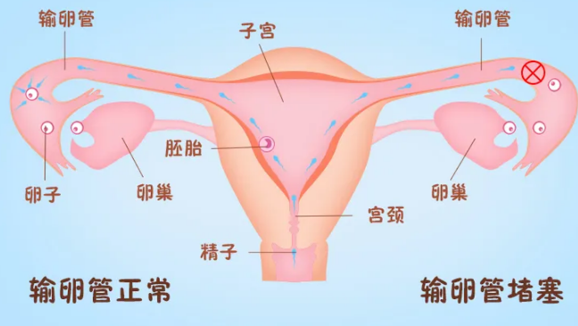 精子怎么进入输卵管?图片