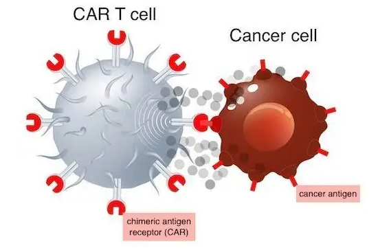 行业资讯丨肿瘤初期,越早使用 car-t 疗法,预后结果越好