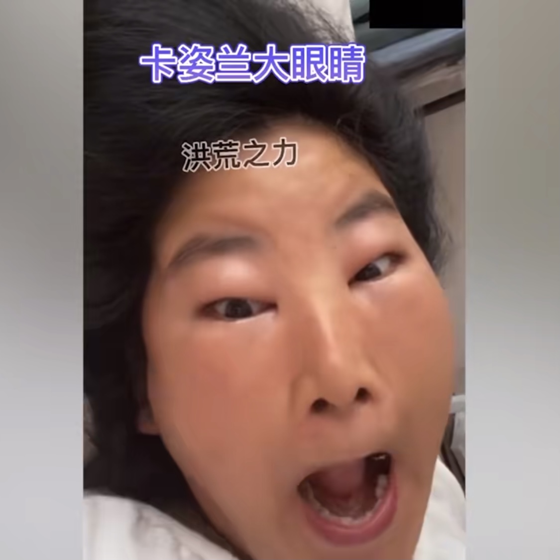 郑州大范围消杀,女子好奇把头伸到窗外被喷,脸肿成包子:形象全毁了