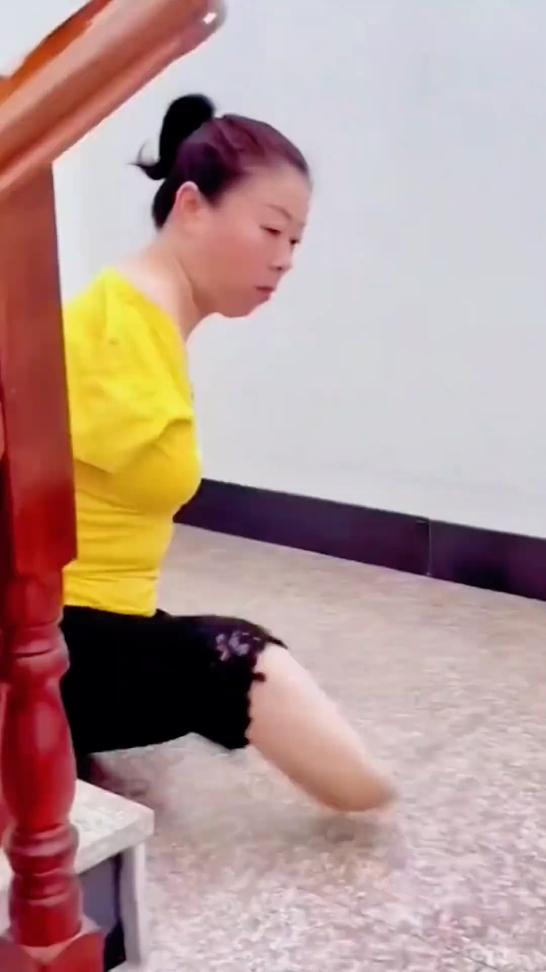 一场意外失去了双手双脚#身残志坚#关爱残疾人#传递正能量