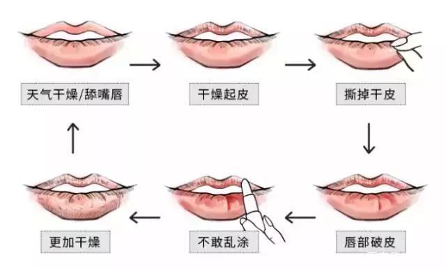 嘴唇各部位名称图片图片