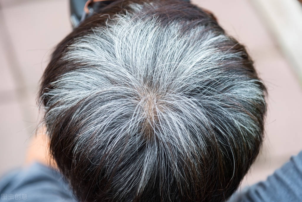 长白头发的人不易患癌吗?白头发和癌症没有太大关系