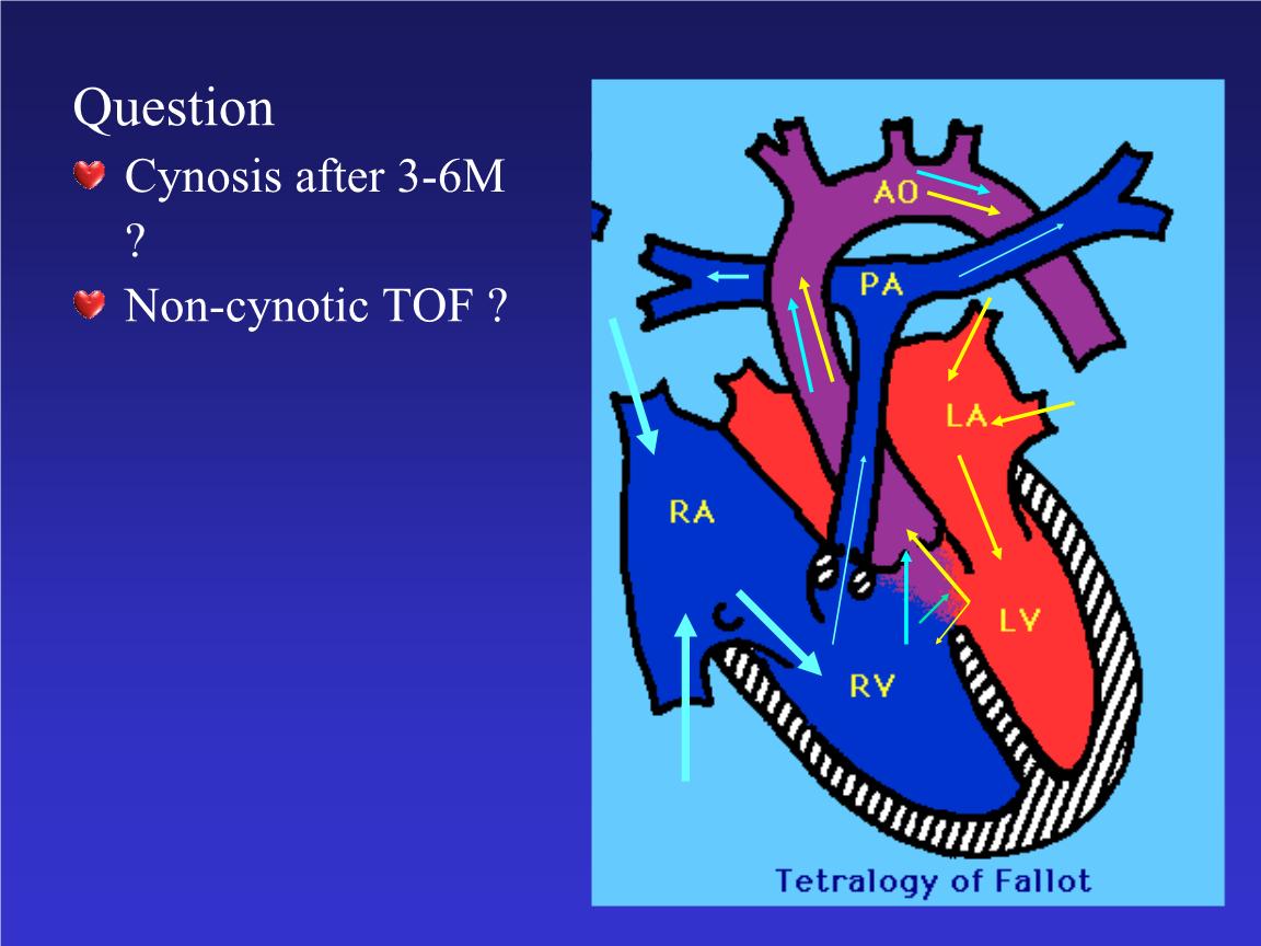 病毒感染是急性心包炎的主要病因,对患者的治疗要采取对症治疗
