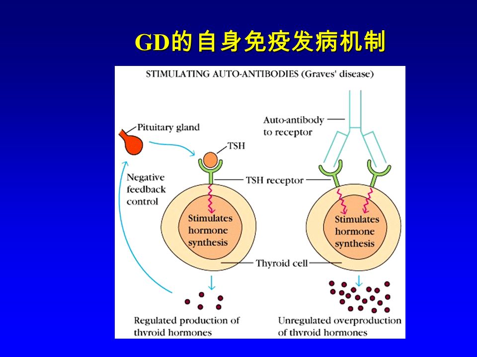 gd病主要由于细胞免疫导致,基因也是病因,目前有3种治疗方式