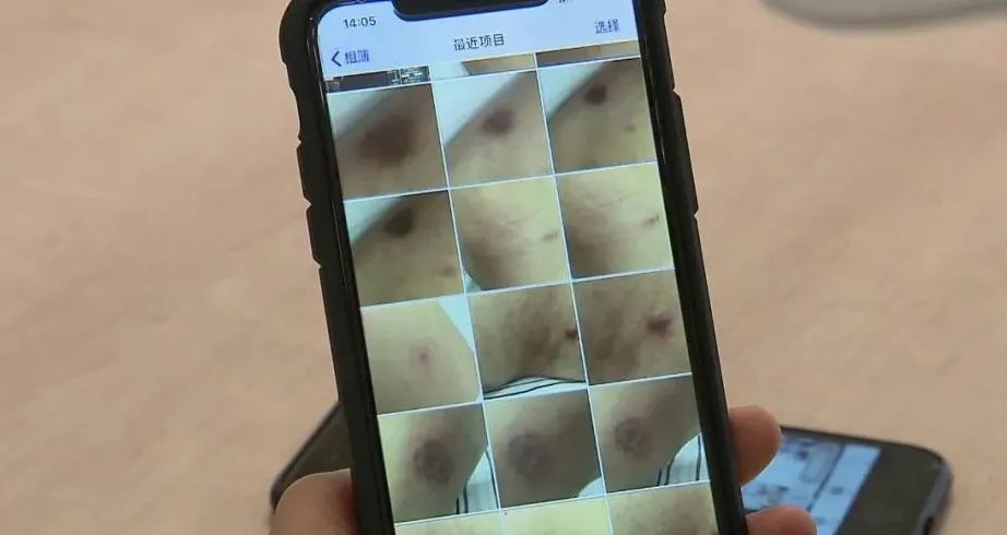 推荐70岁老伯美容院充值576万元!妻子崩溃:人搞成了这副样子