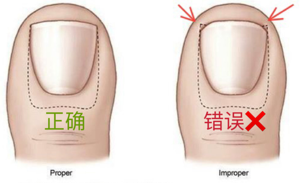 指甲正确剪法图片