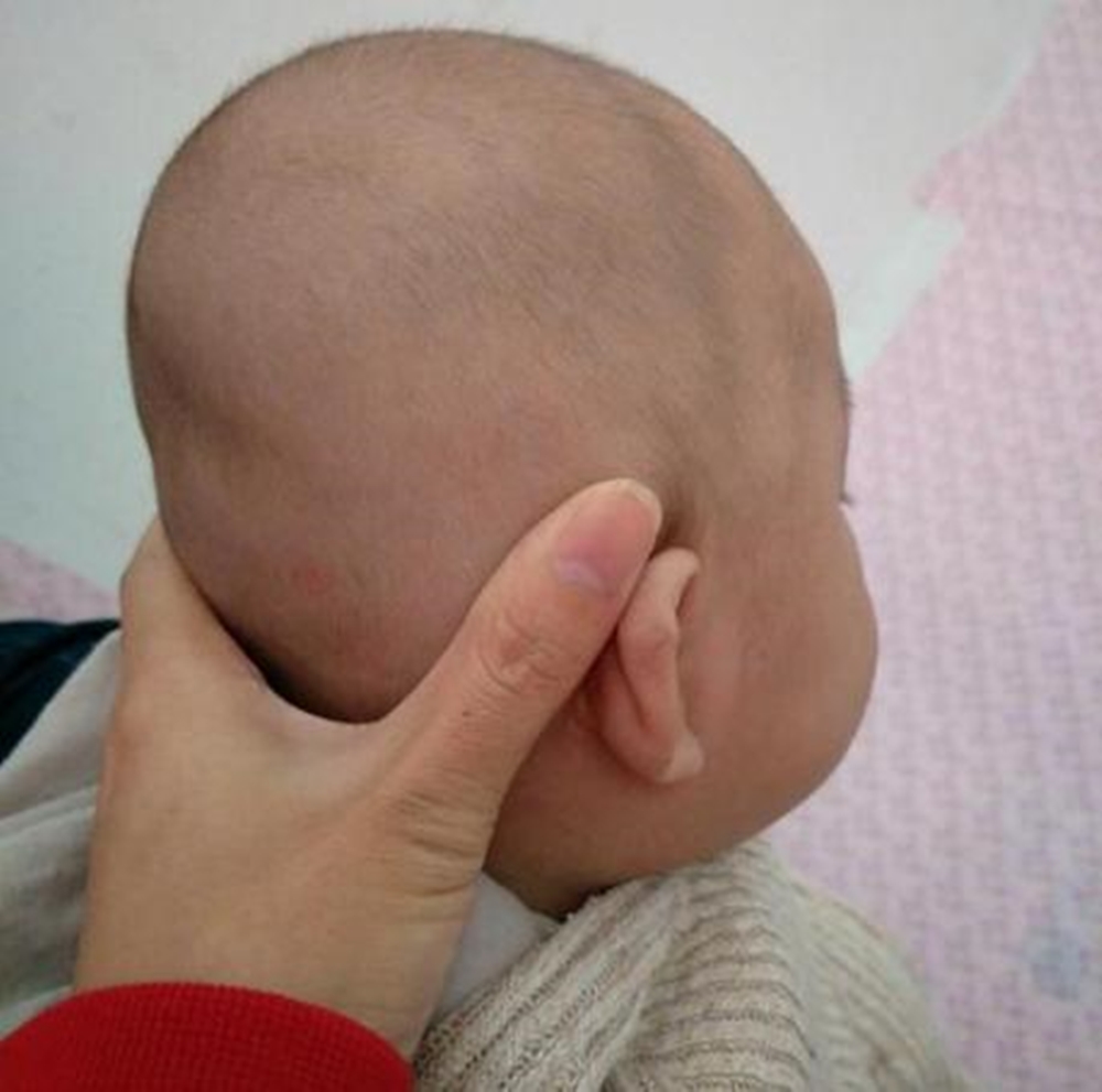 宝宝缺钙的头型图片