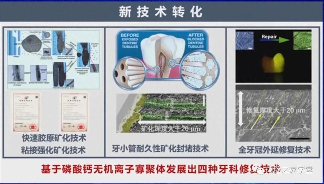 48小时可实现牙釉质再生?对应产品正在临床测试中