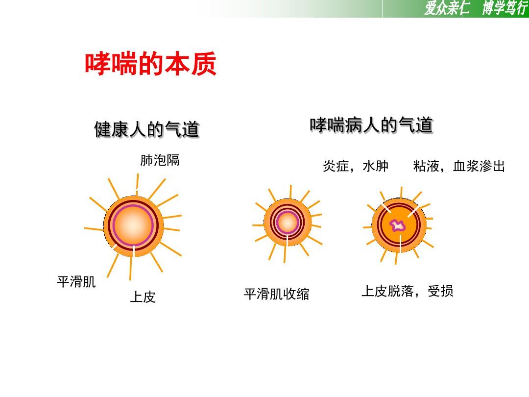 哮喘带给人们的是折磨,积极的预防,对于远离哮喘有极大的帮助