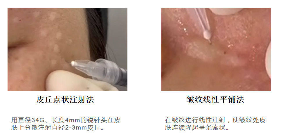 沈海燕博士解读《胶原蛋白对眼周注射的应用》