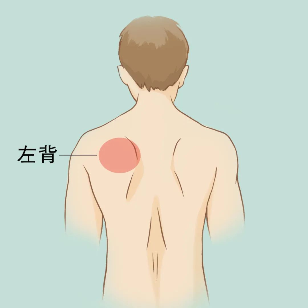 后背疼与多种病有关!一张"疼痛位置图解"看得明明白白