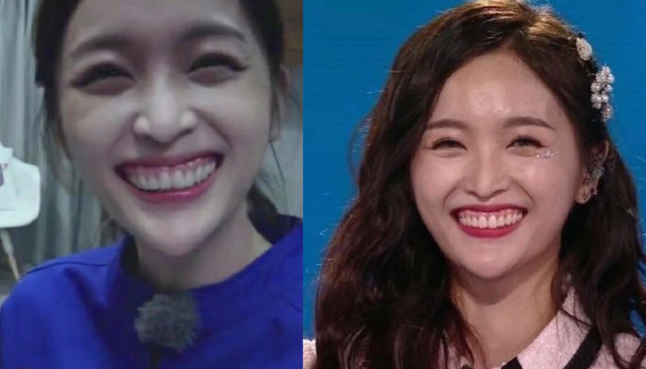 吴宣仪晒照"牙齿"又遭非议,网友再发建议,她听得进去吗?