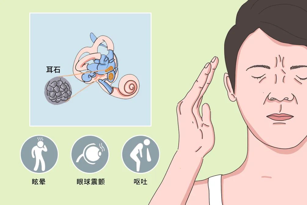 "不简单"的耳石症!