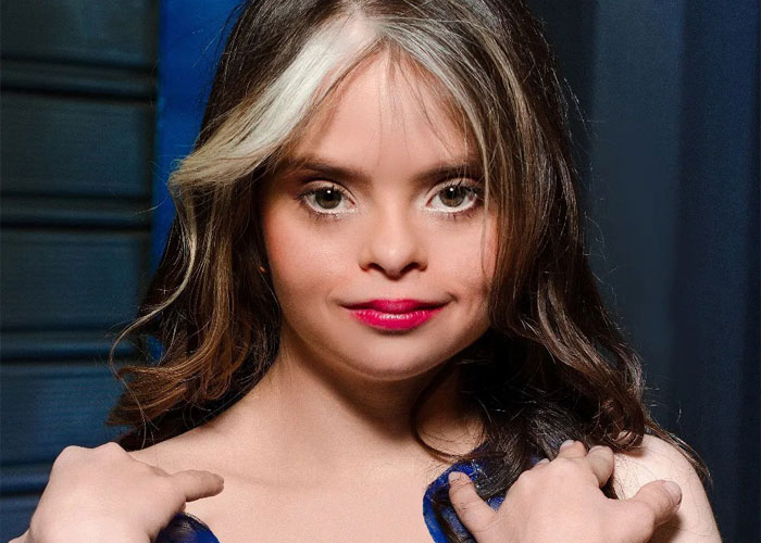 最美的唐氏综合症,她要成为国际模特,天使面孔不再千篇一律