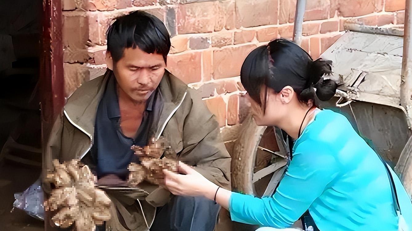 7年前,湖南"树人"刘忠文手脚长满"树枝",如今情况如何