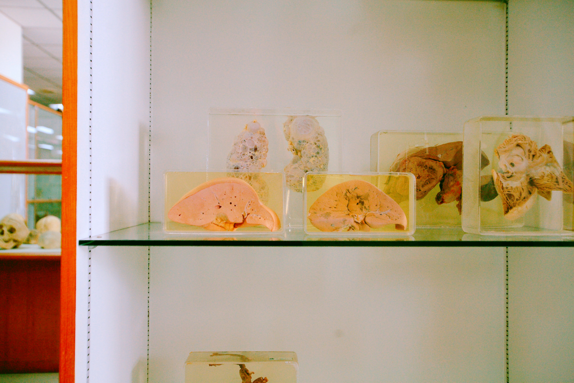曼谷重口味博物馆,存放着很多婴儿标本,当地人都很少去
