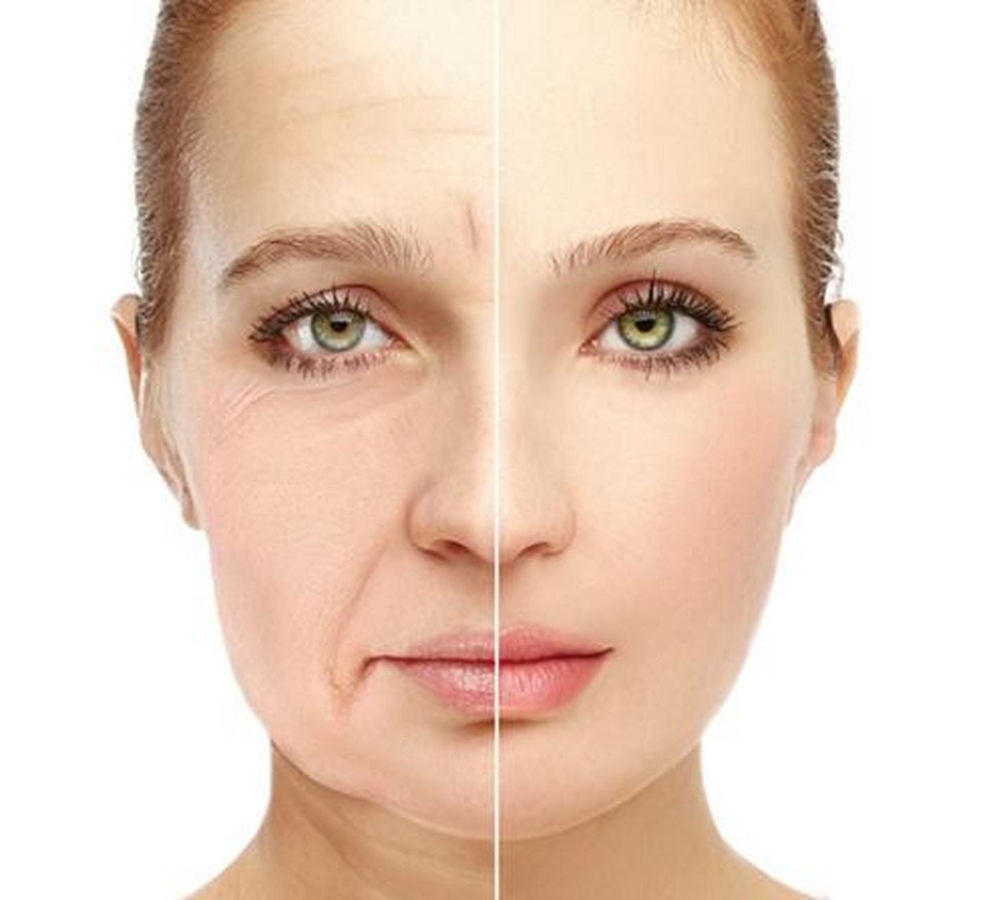 皮肤松弛不仅会影响外貌,还对个人的身体和心理产生了一系列的影响.