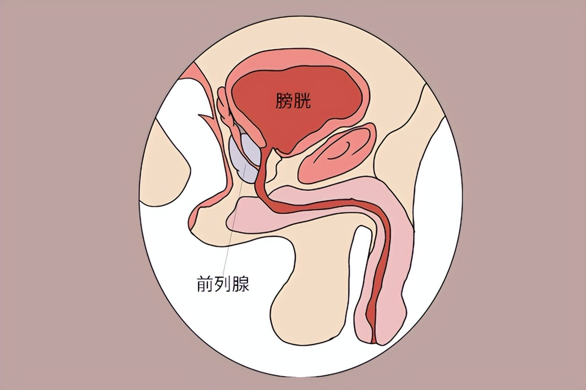 牛肉是发物,前列腺炎不能吃?想要改善前列腺炎,要做好这5件事