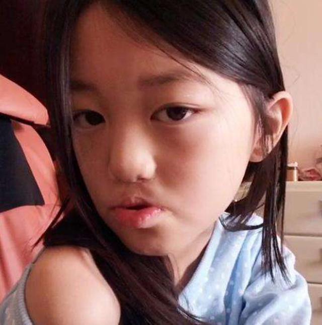 "唇腭裂"李嫣高清照曝光,三次手术后痕迹全无,和爸爸齐做公益