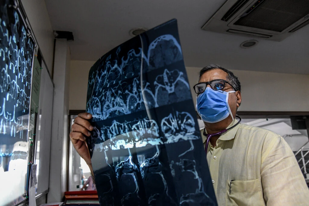 印度大爆恐怖黑真菌病!3万人感染,面部流血摘眼切鼻难保命