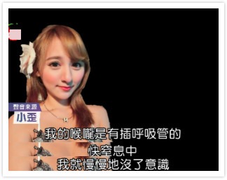 女星孙沐辰自曝遇整容事故,手术台上突然惊醒,喉咙插管差点窒息