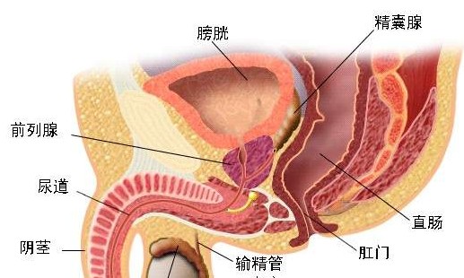 肉芽肿性前列腺炎,与尿路感染有关,部分患者发病可能与遗传有关