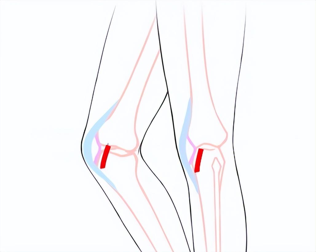 漫画人物膝盖画法