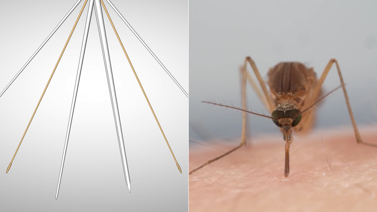 驱除蚊子不用蚊香也可以,白醋就能搞定,蚊子闻了有多远跑多远