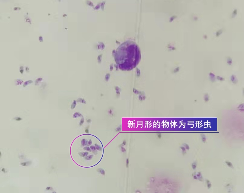 刚地弓形虫滋养体绘图图片