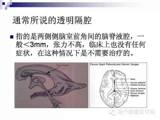 透明隔间腔你真的会诊断吗?