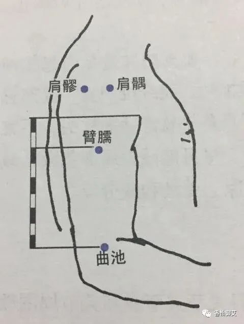 甲状腺结节艾灸图图片