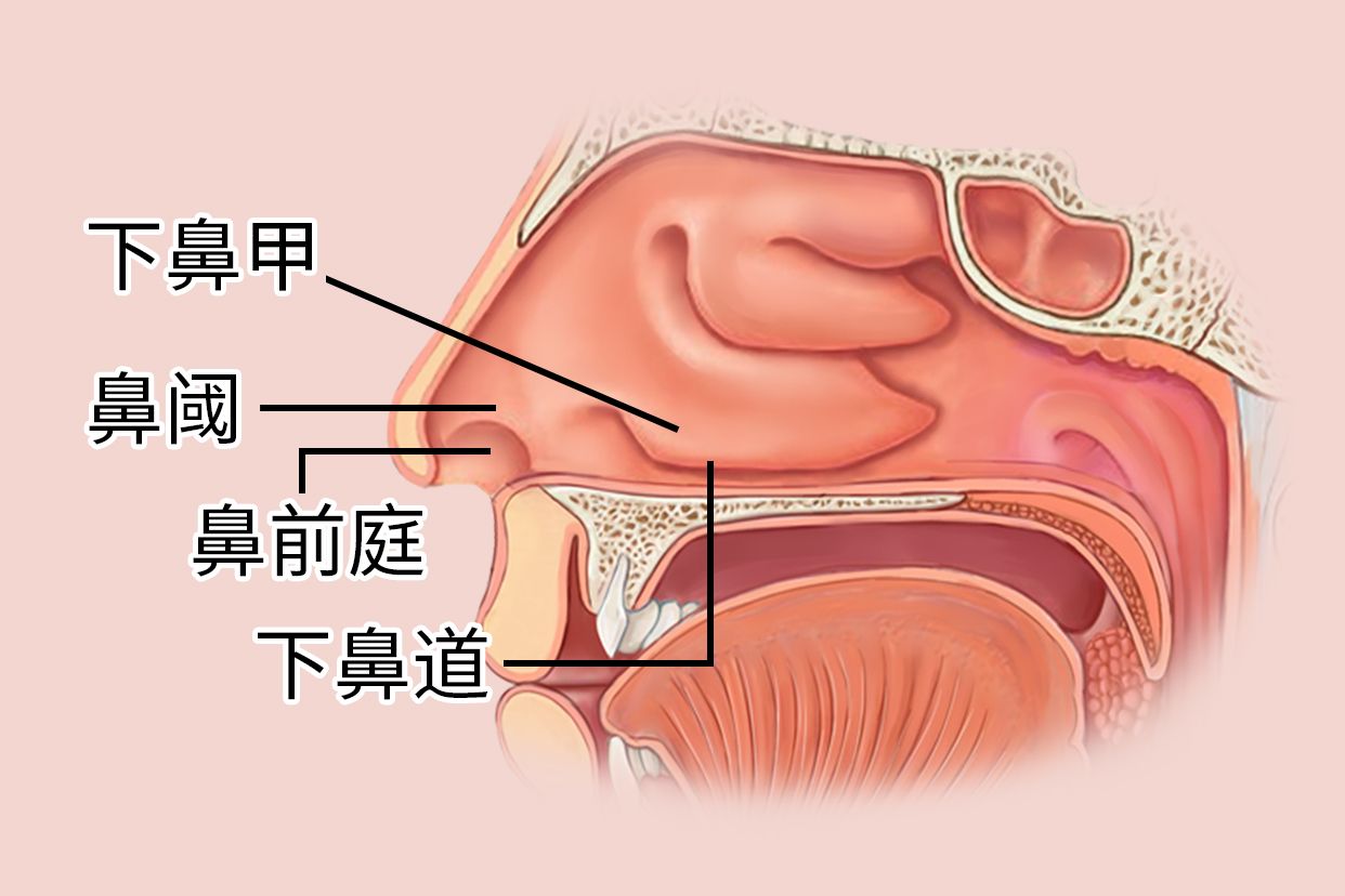 三甲医院做切除鼻前庭囊肿手术大概需要多少钱呢?