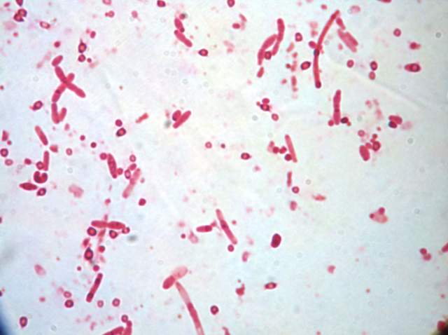 炭疽芽孢杆菌荚膜图片