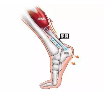 跟腱准确位置图图片