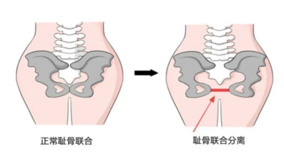 生完娃