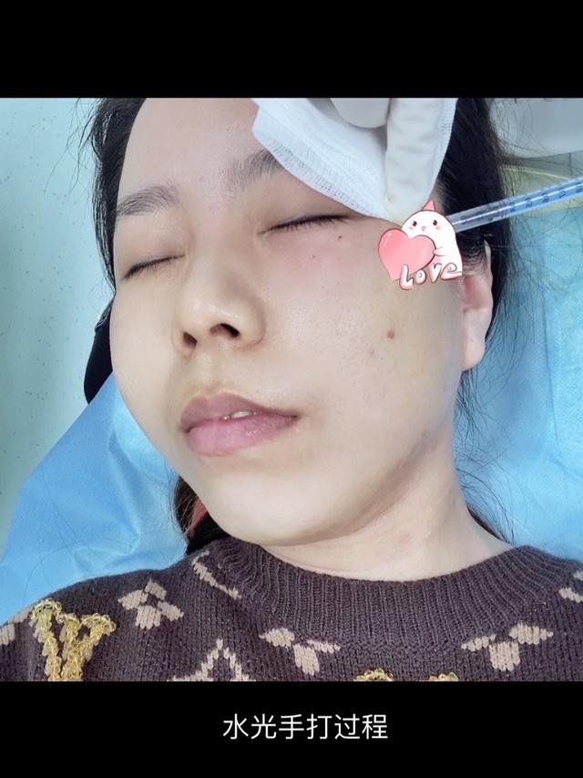 水光针可以改善哪些肌肤问题?一次能维持多长时间?