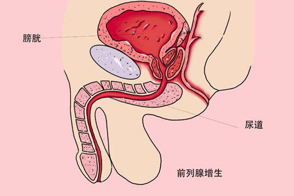 年过半百,雄激素依旧旺盛,究竟是好是坏?他的经历给人启示