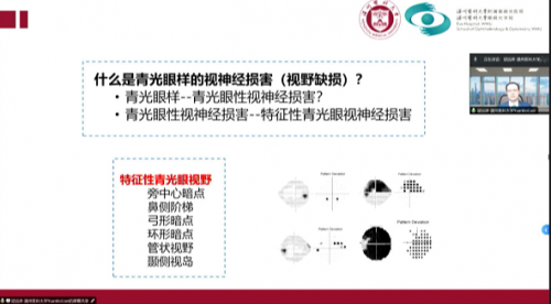 青光眼鼻侧阶梯图片