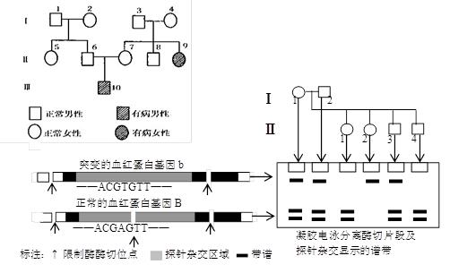 镰刀形细胞图片