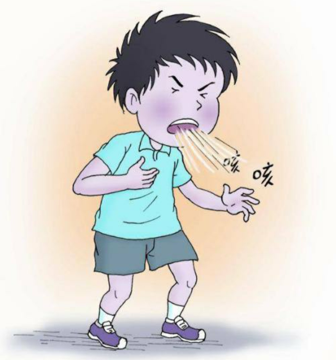 热纳综合症又叫窒息性胸腔失养症,常染色体隐性遗传病,积极预防