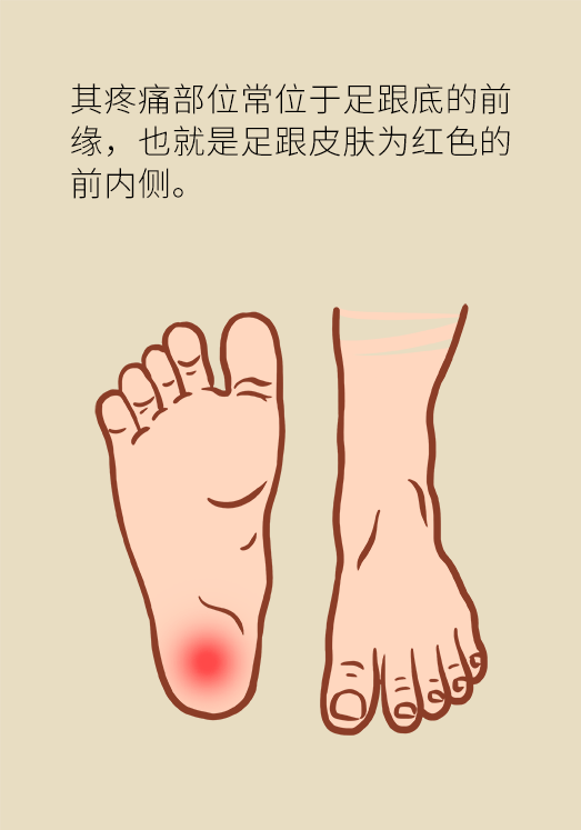 脚后跟痛有哪些原因,七招帮你缓解疼痛