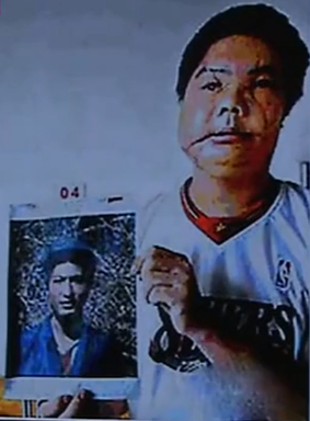 中国换脸第一人李国兴,2006年背60斤西药回家,两年后离奇去世