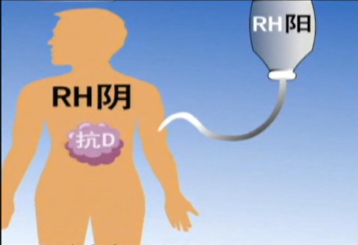 回顧女孩被醫院輸錯了血52歲母親08年想為她代孕這是為何