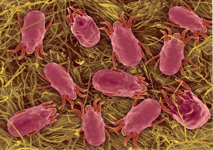 螨虫最大的天敌,竟然不是暴晒?床上放点"它",螨虫消失了