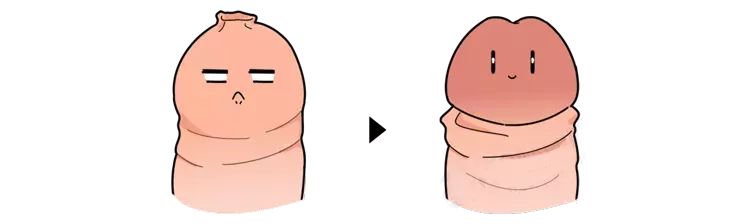 男人不割包皮,丁丁患癌的几率有多大?